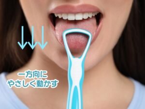 口臭の原因となる舌苔の予防・除去に効果的な舌ケア方法