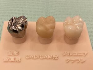 CAD/CAM冠とジルコニア冠の比較