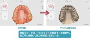 型取りの変化